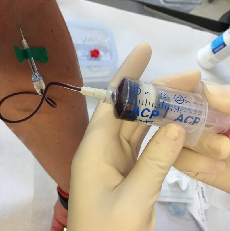 Acp Therapie Kostenbernahme