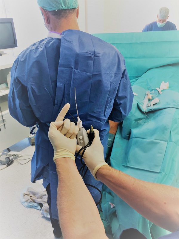 Arthroskopie des Knies in neuen Nano-Verfahren - besonders schonende Kniespiegelung