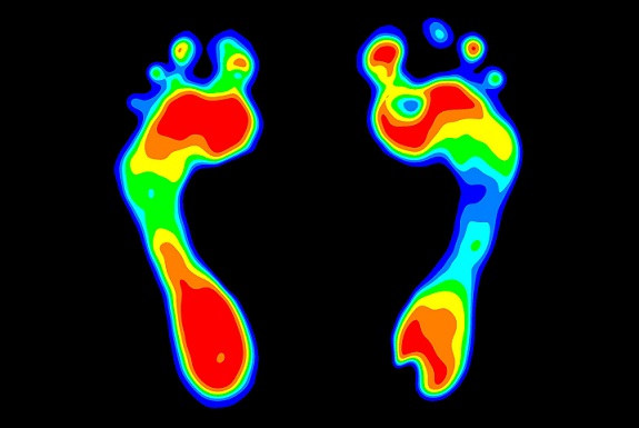 Fuß vermessen lassen - Digitale Fuß- und Ganganalyse für Einlegesohlen
